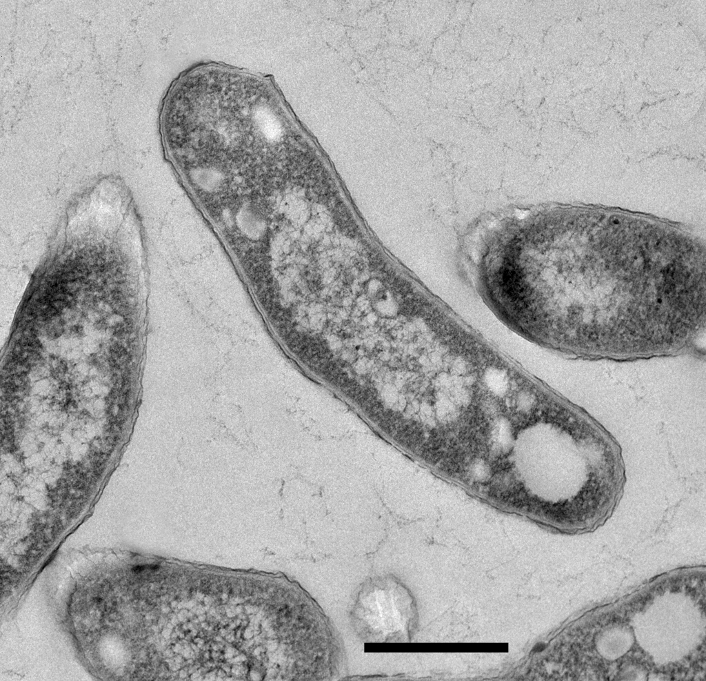 Визуализация клеточного цикла Mycobacterium tuberculosis на уровне одной клетки выявляет линейный и гетерогенный рост