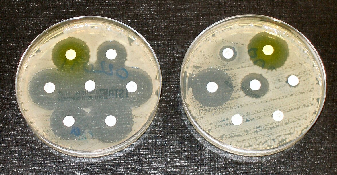 Прогнозирование смертности от сепсиса в эпоху панрезистентной E. coli с помощью моделирования