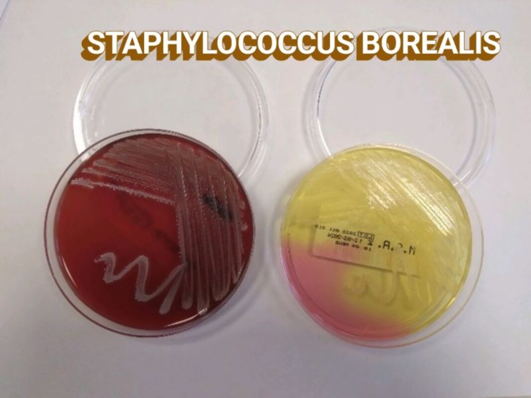 Выявление клинической значимости Staphylococcus borealis