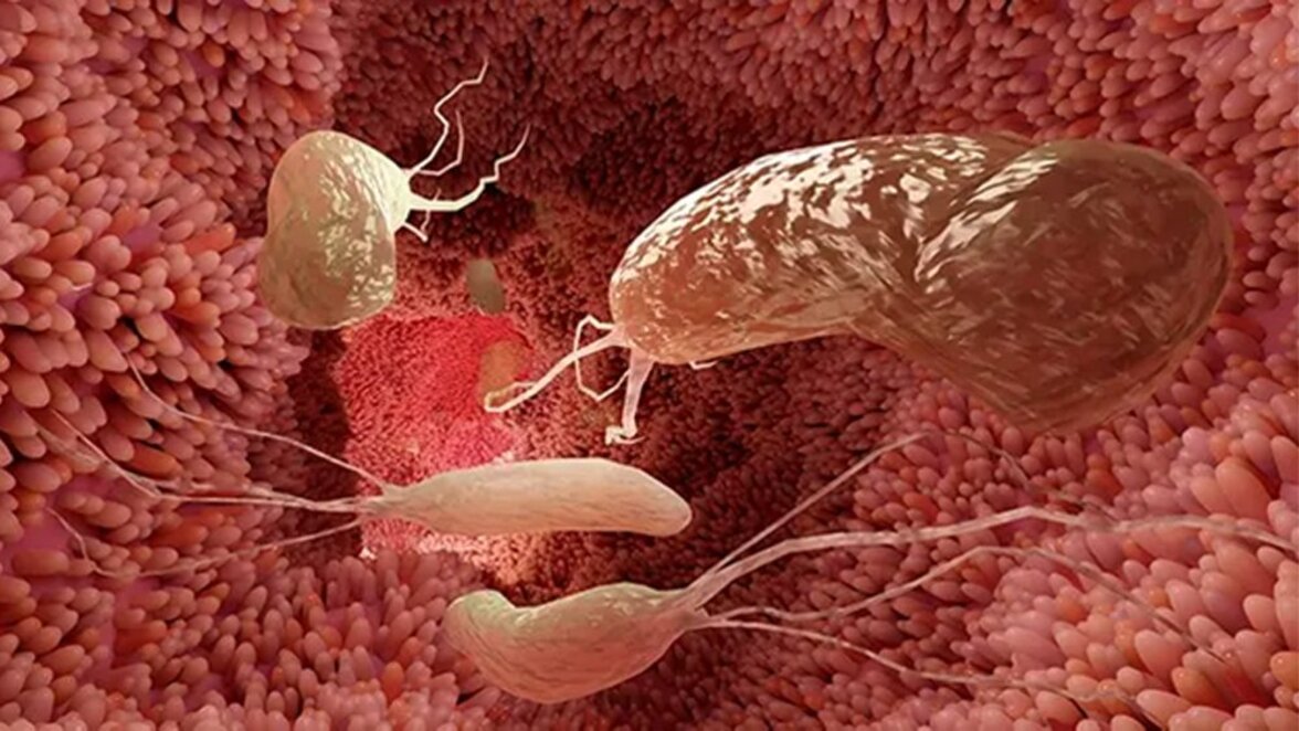 Белок Helicobacter pylori является мощным ингибитором образования амилоида 