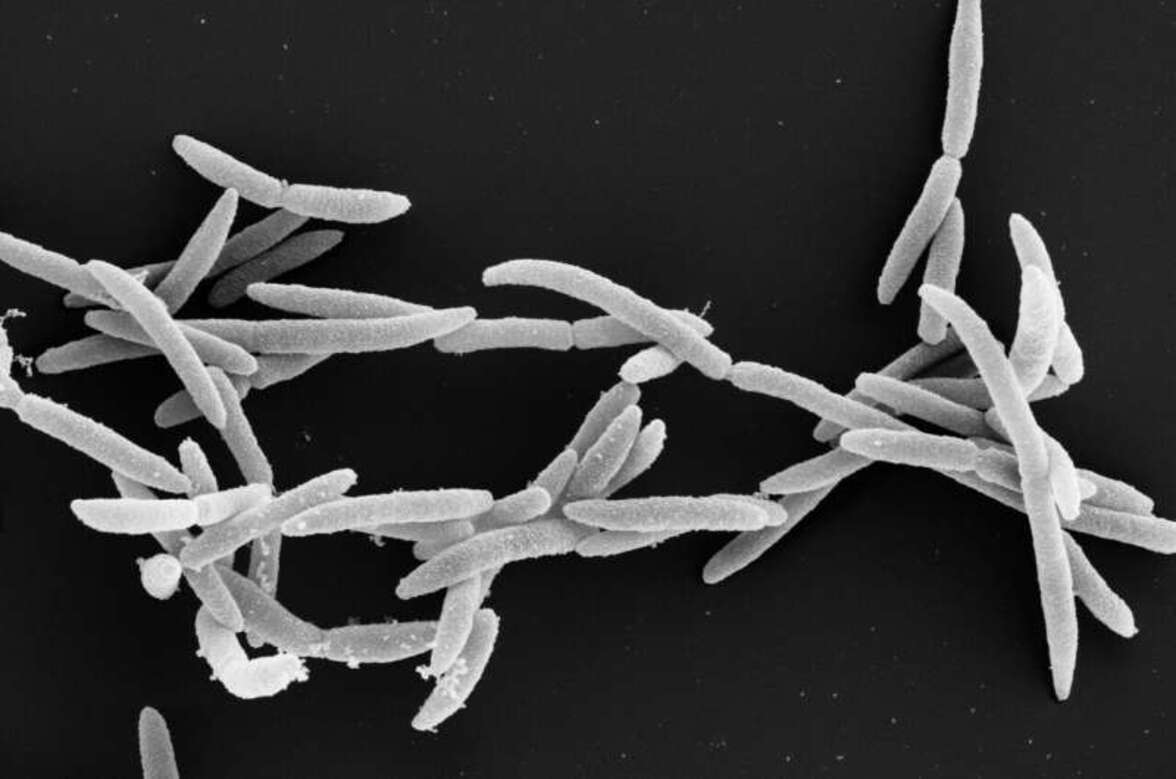 Неожиданный блокатор оральных видов Fusobacterium, связанных с прогрессированием рака