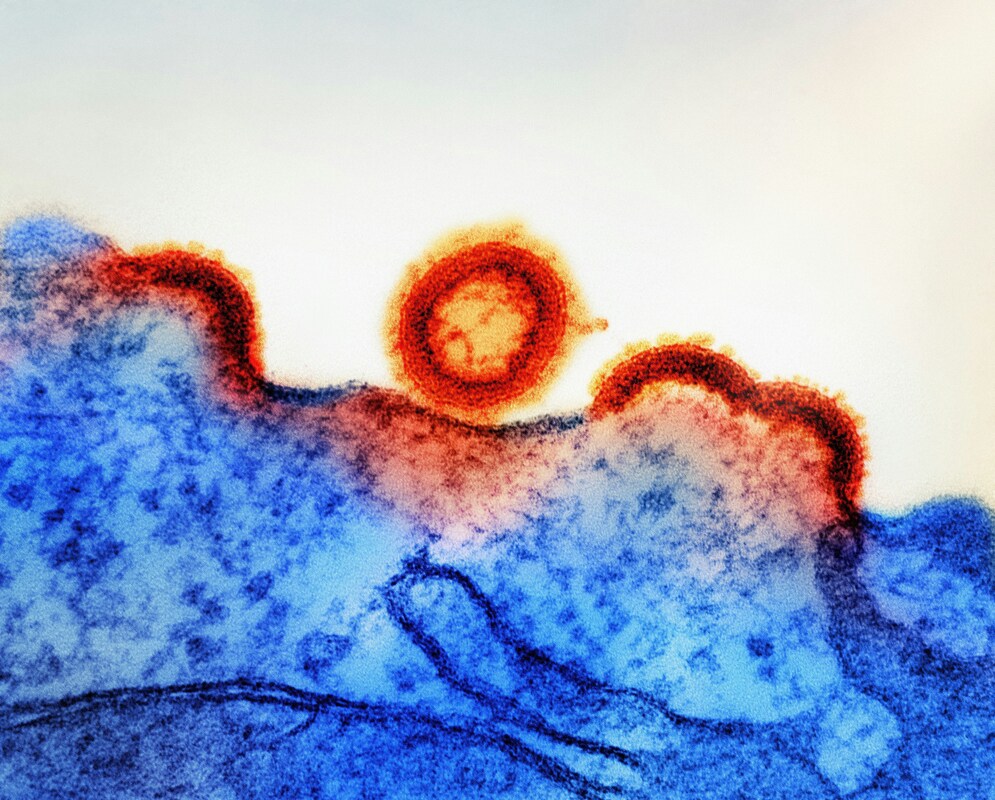 Понимание структуры интегразы ВИЧ открывает путь к новым терапевтическим средствам