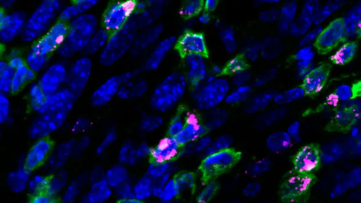 Терапевтическая вакцина против ВПЧ уменьшила опухоли шейки матки у мышей