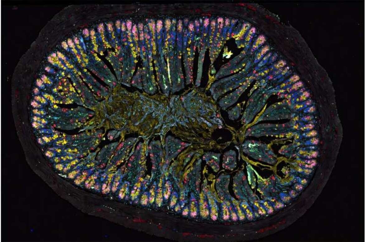 «Кишечный мозг» играет центральную роль в развитии аллергии