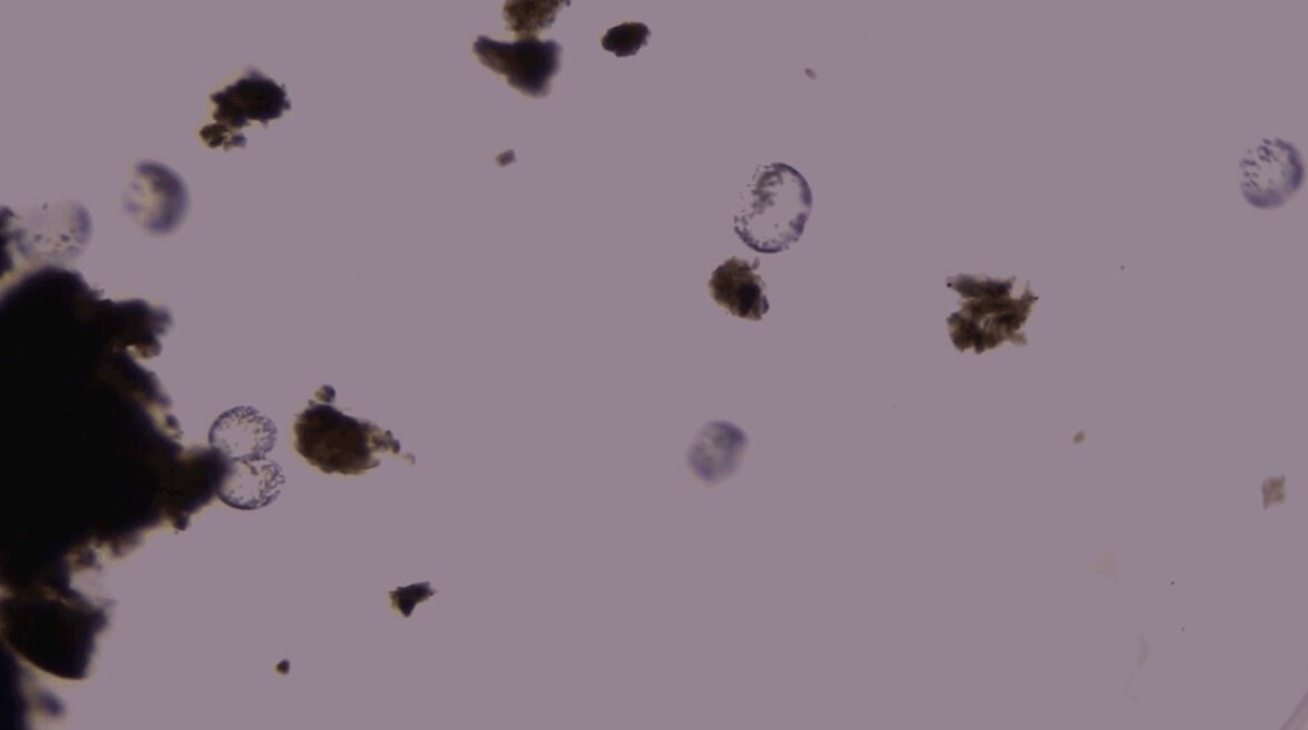 Этот гигантский микроб организует свою ДНК удивительным образом