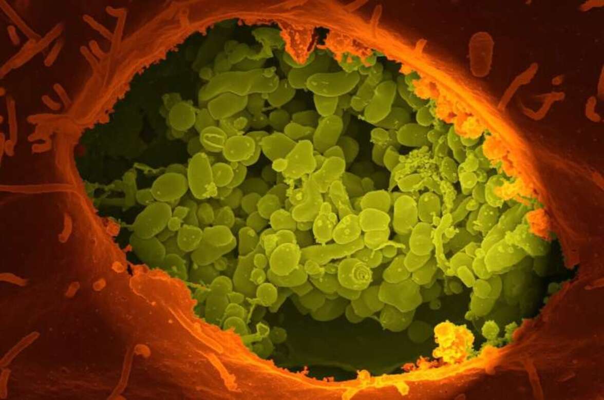 Кишечные бактерии меняются на ранних стадиях воспалительных заболеваний кишечника