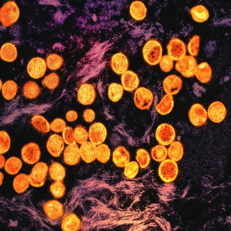 Антистафилококковые пенициллины в сравнении с цефазолином при метициллин-чувствительной бактериемии S. aureus: имеет ли значение определение типа BlaZ?