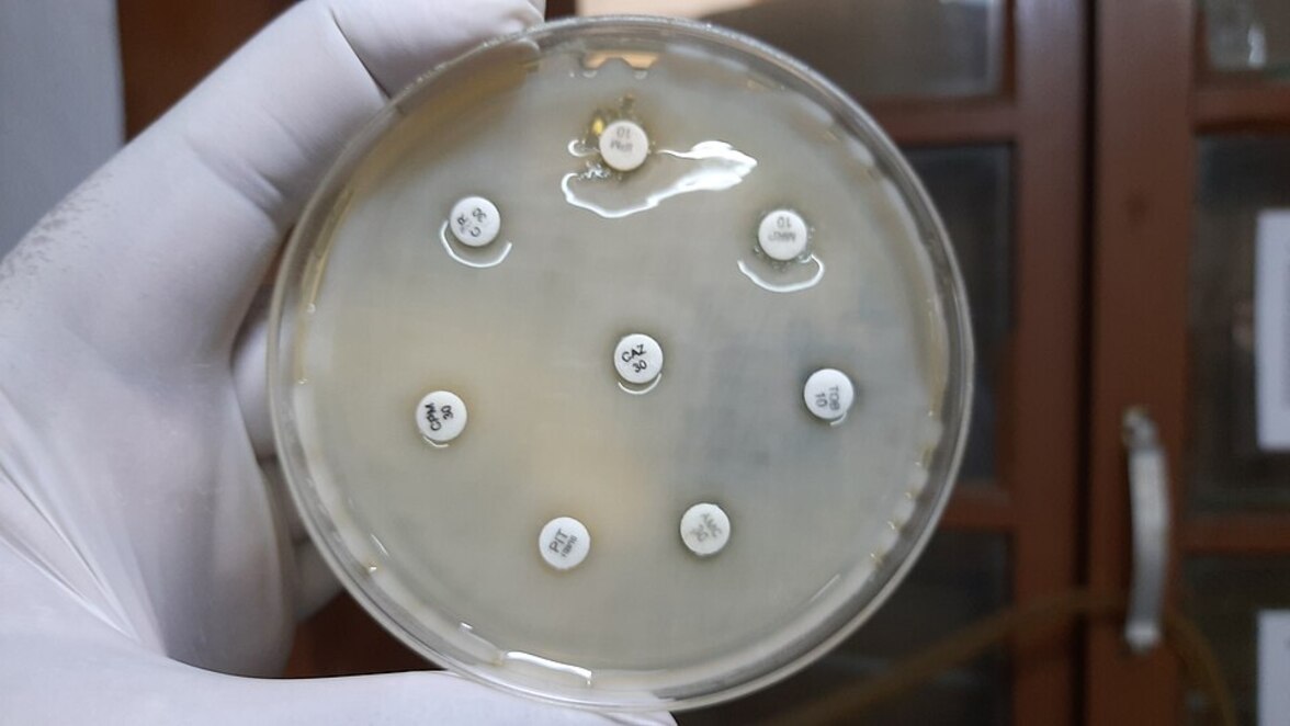 Резистентность, передаваемая плазмидами, способствует глобальному распространению опасных штаммов клебсиеллы
