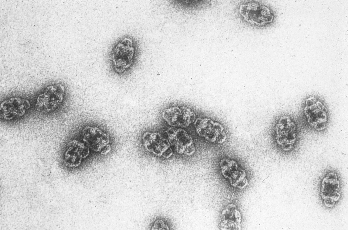 Ученые превращают самые загадочные структуры клеток в "шпионов" за генетической активностью