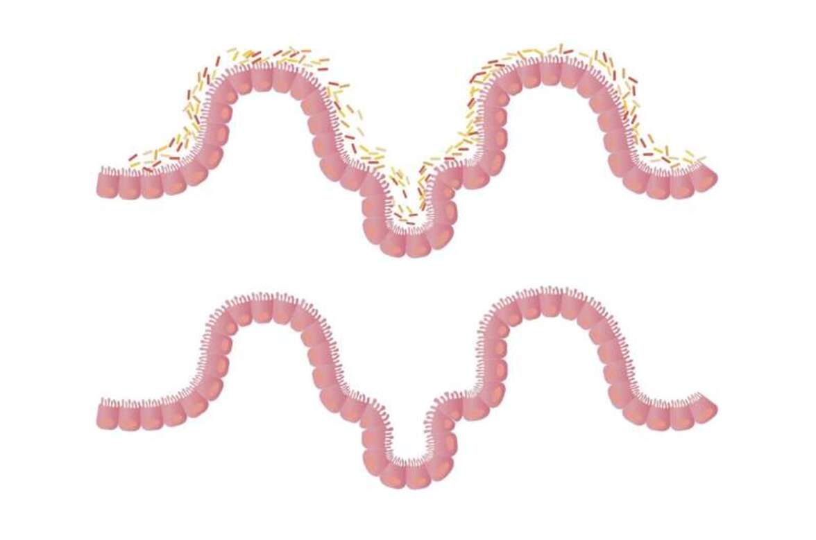 Исследования показывают, что кишечные микробы укрепляют иммунитет у пациентов с ВИЧ
