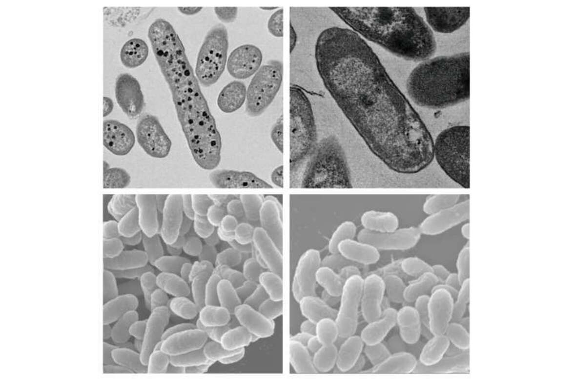 "Бактериальный запор": кишечные комменсальные бактерии, разрушающие муцин, вызывают запор
