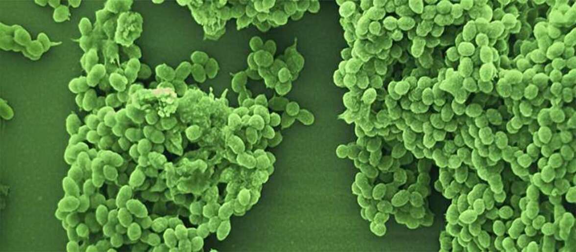 Потеря кворум сенсинга способствует образованию биопленки и ухудшает исходы при энтерококковом инфекционном эндокардите