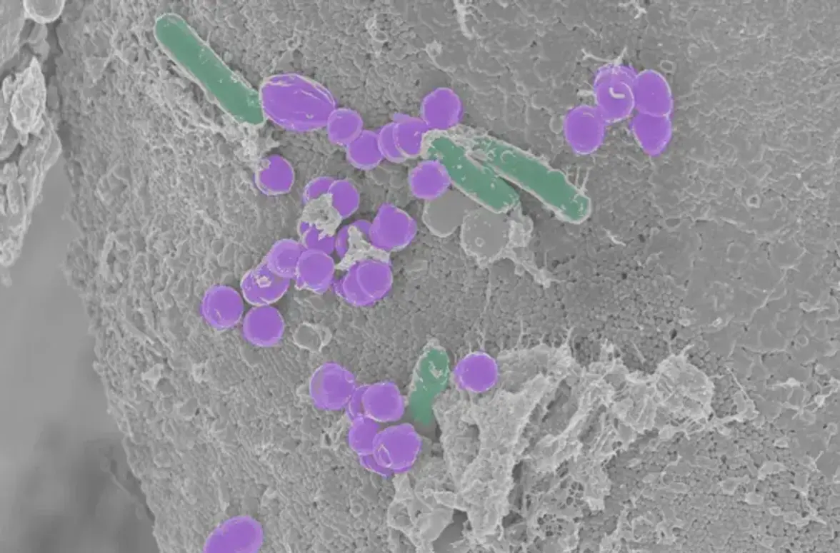 Микробные взаимодействия выступают в качестве неинвазивного биомаркера здоровья кишечника