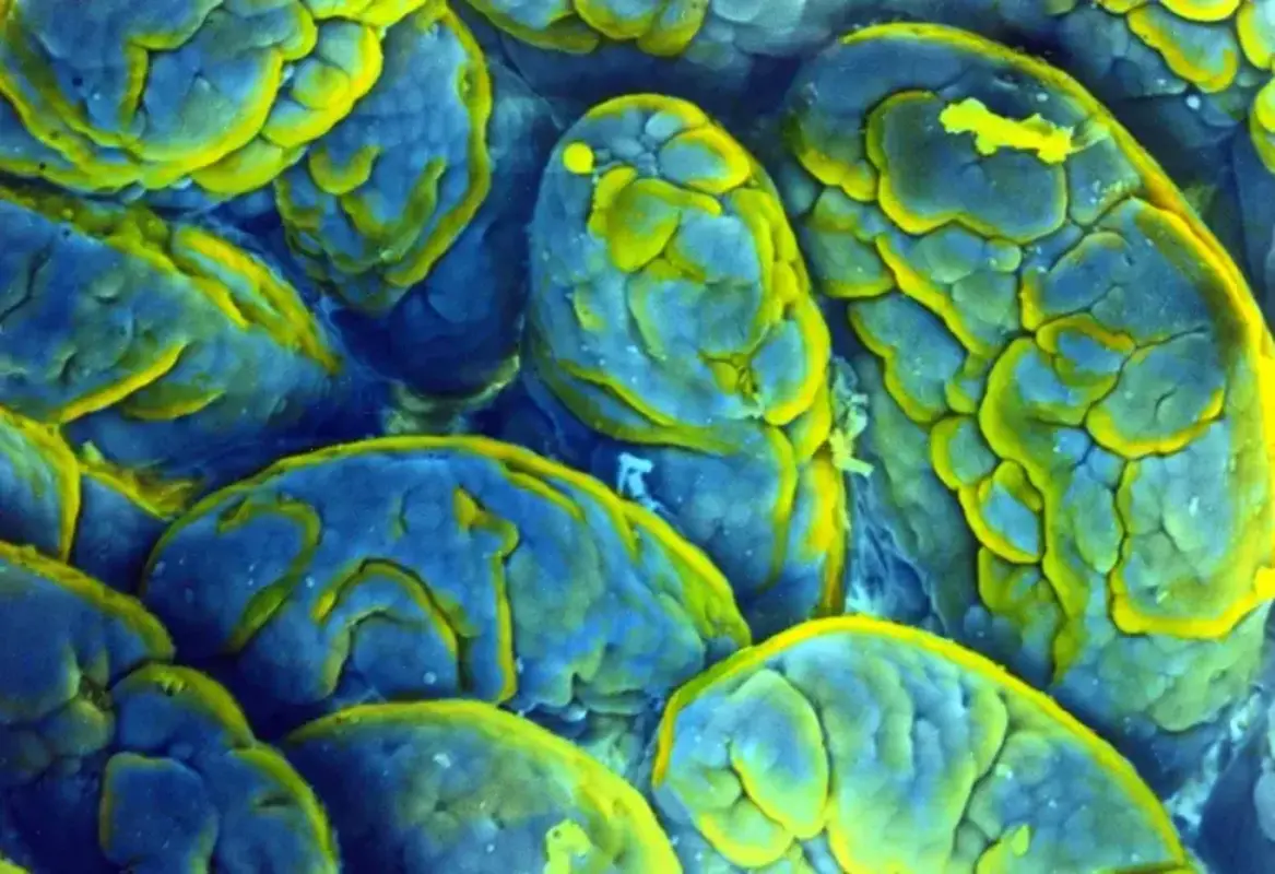 У стареющих мышей потерю памяти усугубляют микроорганизмы кишечника