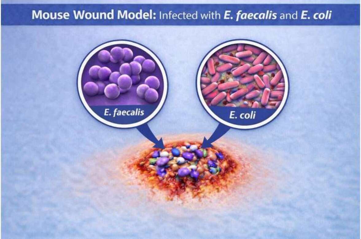 Как бактерии подавляют иммунную защиту при трудноизлечимых раневых инфекциях