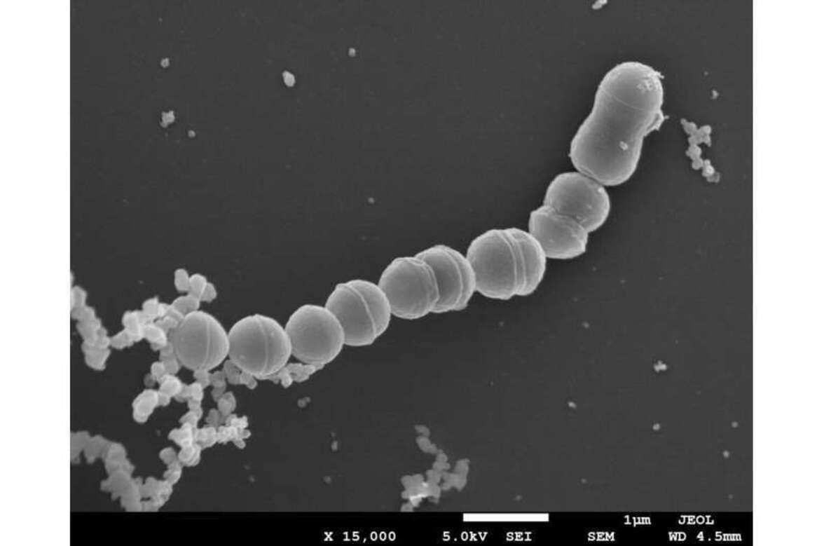 Мутантные штаммы стрептококка группы В могут объяснять инфекции у новорожденных