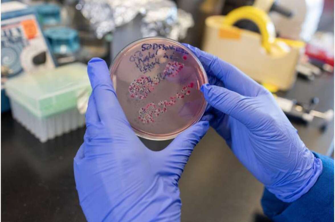 Как дисбаланс микробиома кишечника усугубляет хроническую болезнь почек