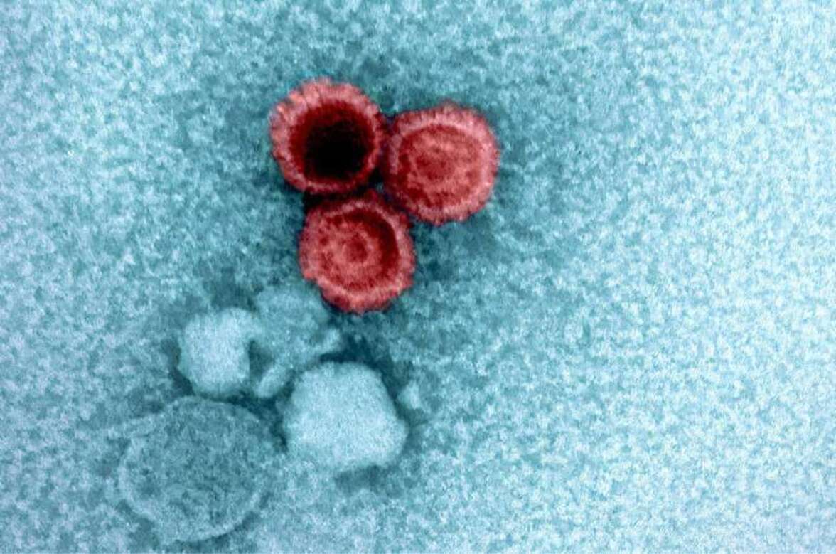 Почему некоторые вирусы остаются в организме на всю жизнь? Исследование с участием 900 000 человек позволяет составить карту вирусной нагрузки