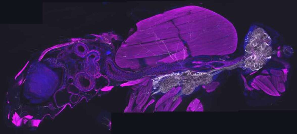 Двунаправленная ось мозг-жировая ткань тела предотвращает попадание патогенов