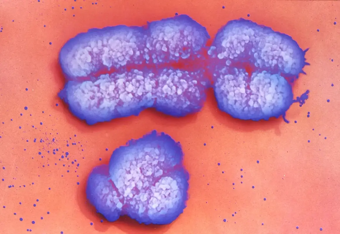 Недооцененная половая хромосома: как Х-хромосома влияет на здоровье