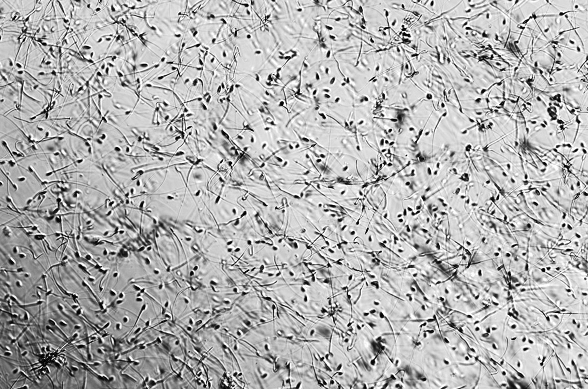 Сперматозоиды несут неожиданные генетические сообщения