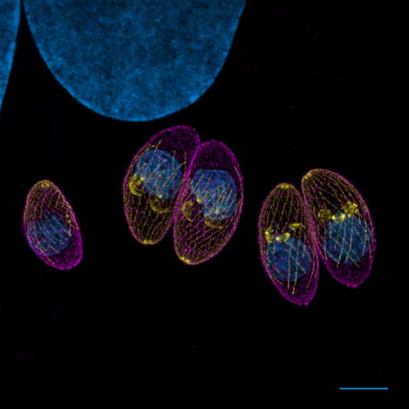 Ключевой белок помогает выживать Toxoplasma gondii 
