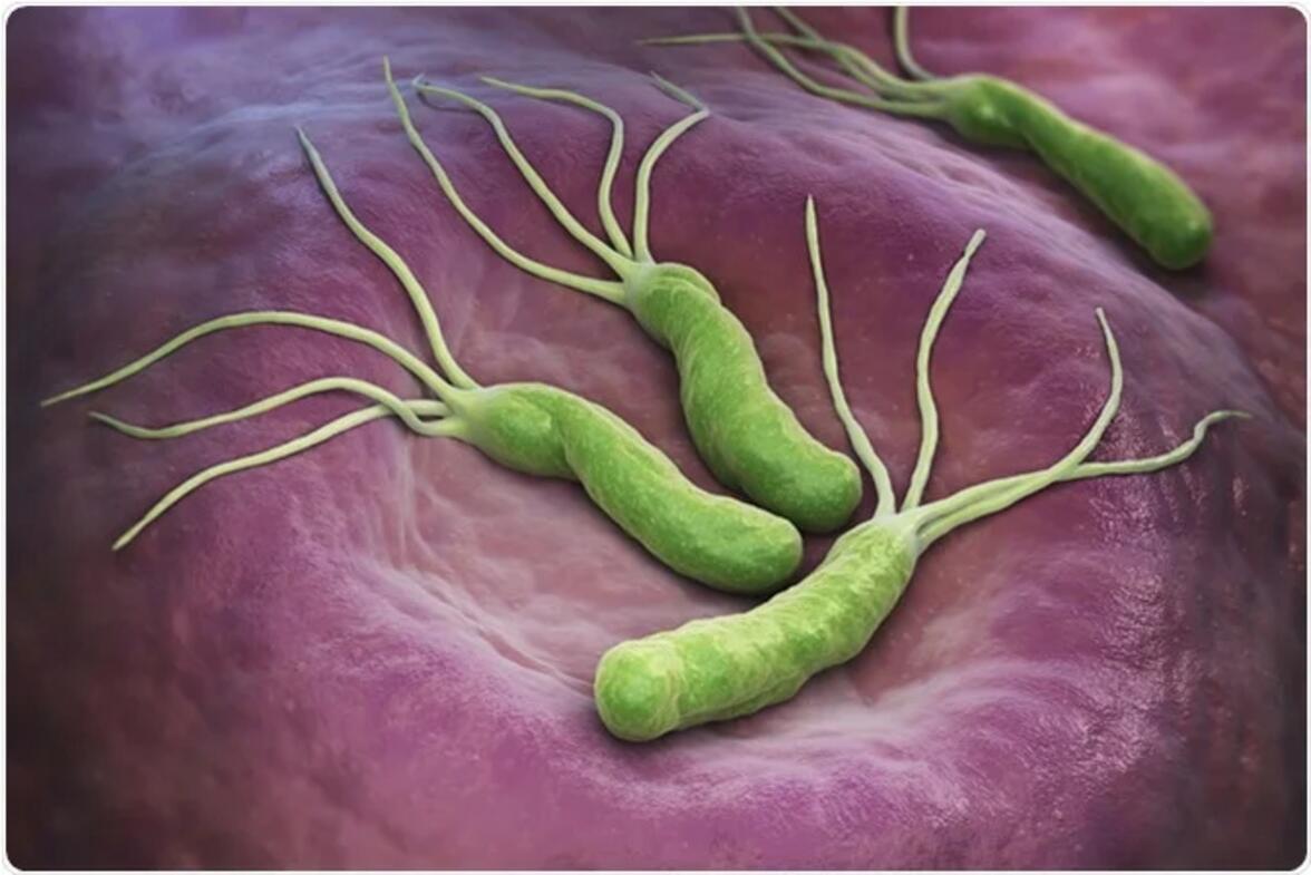 Helicobacter pylori может быть связана с 22% случаев колоректального рака