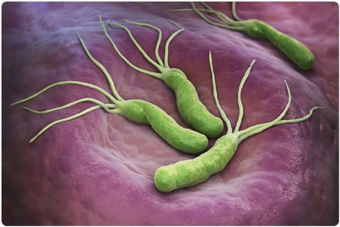 Helicobacter pylori может быть связана с 22% случаев колоректального рака